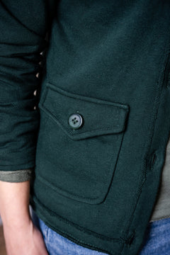 Raw Hem Button Front Cardigan Jacket